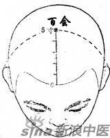 艾灸百会治耳性眩晕